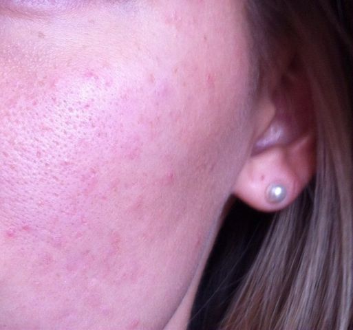 Нормализующий тональный крем с устойчивым матирующим эффектом Ever Matte spf 15 Oil-Free (оттенок № 108 Sand) от Clarins фото 7
