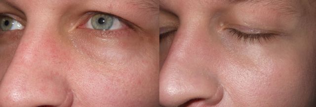 Увлажняющее средство с тоном и защитой Skincare Tinted Moisture Protection SPF20 от Shiseido фото 4 Увлажняющее средство с тоном и защитой Skincare Tinted Moisture Protection SPF20 от Shiseido фото 4