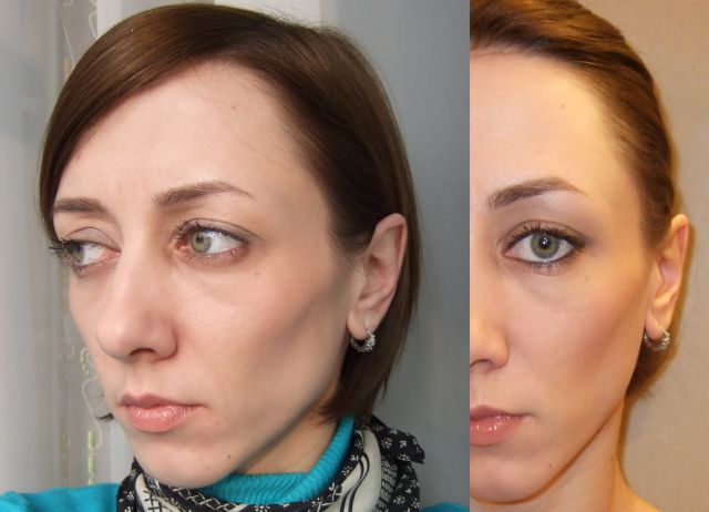 Увлажняющее средство с тоном и защитой Skincare Tinted Moisture Protection SPF20 от Shiseido фото 10 Увлажняющее средство с тоном и защитой Skincare Tinted Moisture Protection SPF20 от Shiseido фото 10